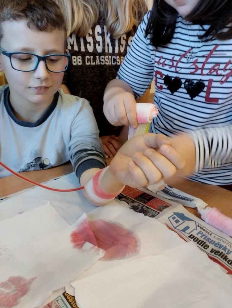 Tepenné krvácení – naši zdravotníci zasahují